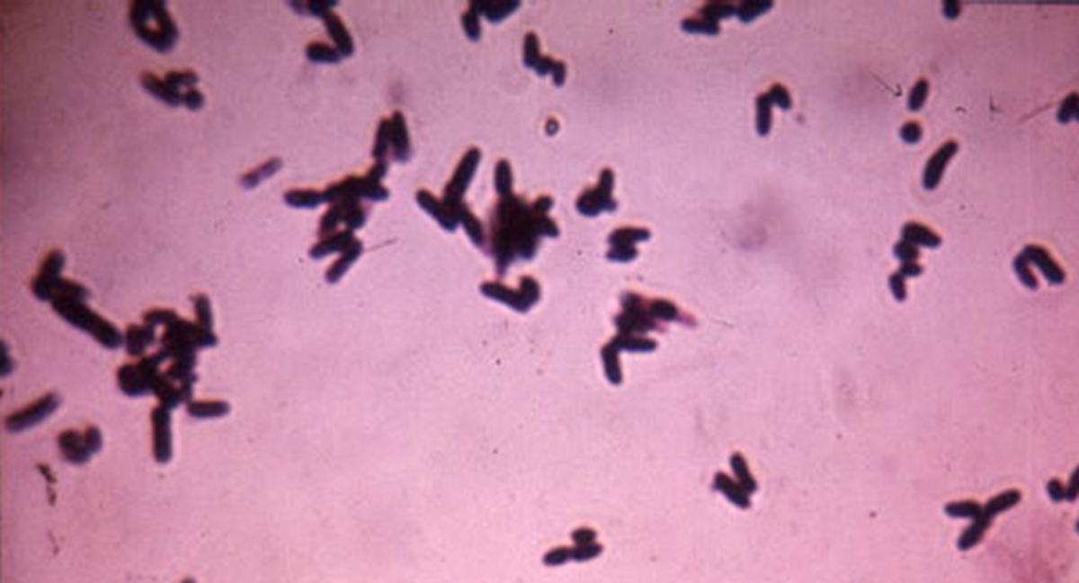 Corynebacterium diphtheriae