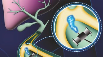 Микроскопические роботы-поезда помогают в борьбе с раком