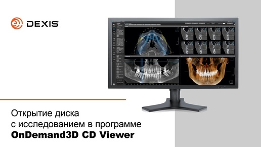 Открытие диска с исследованием в программе OnDemand3D CD Viewer