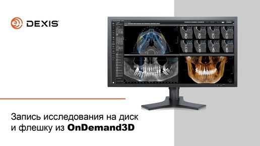 Запись исследования на диск и флешку из OnDemand3D | DEXIS Russia