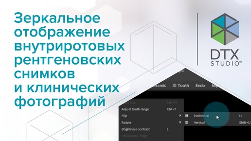Зеркальное отображение внутриротовых рентгеновских снимков и клинических фотографий | DTX