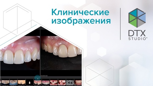 Клинические изображения | DTX Studio Clinic