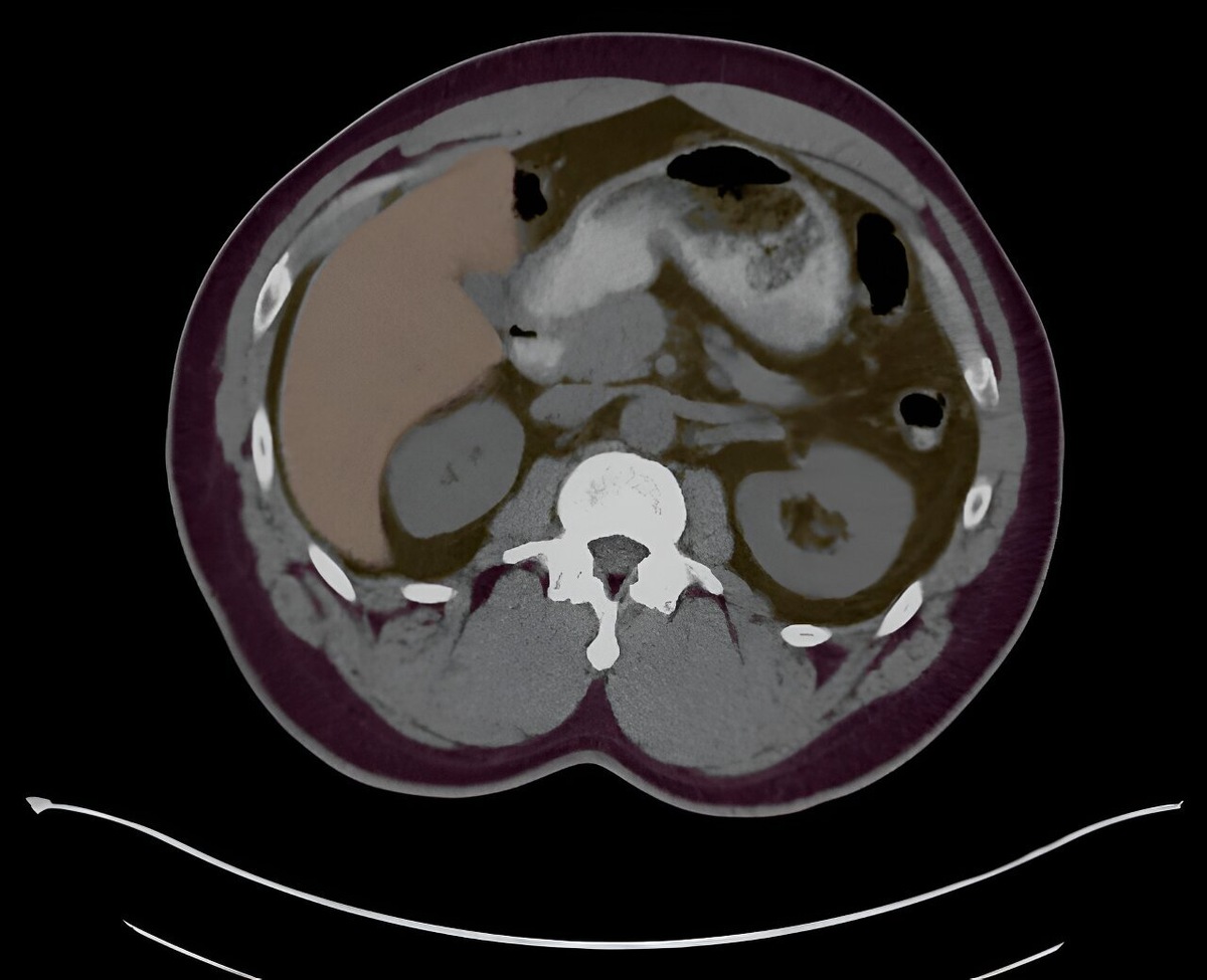    Journal of Imaging Informatics in Medicine