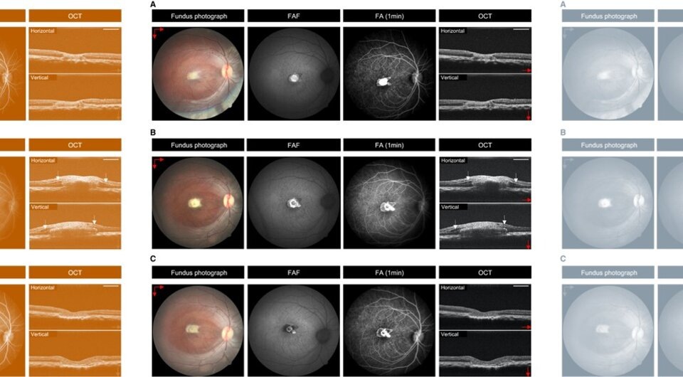   Michiko Mandai et al. / Stem Cell Reports, 2024