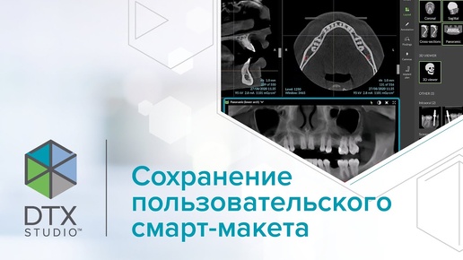 Сохранение пользовательского смарт-макета | DTX Studio Clinic