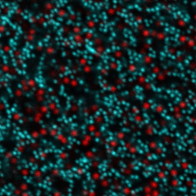 Конфокальное микроскопическое изображение бимодальной привлекательной коллоидной суспензии в эксперименте Bimodal Colloid. Фото: nasa.blog.com