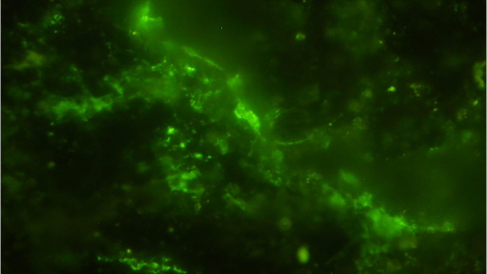    Фото: Y. Suzuki et al./ Microbial Ecology, 2024, Древние микробы окрашены зеленым