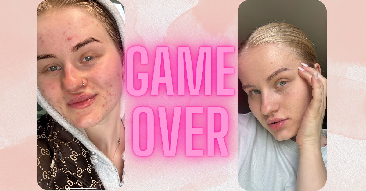 разница в фото 1,5 года