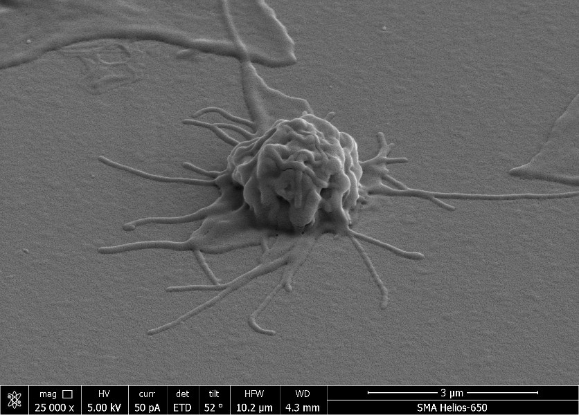 Активированный тромбоцит