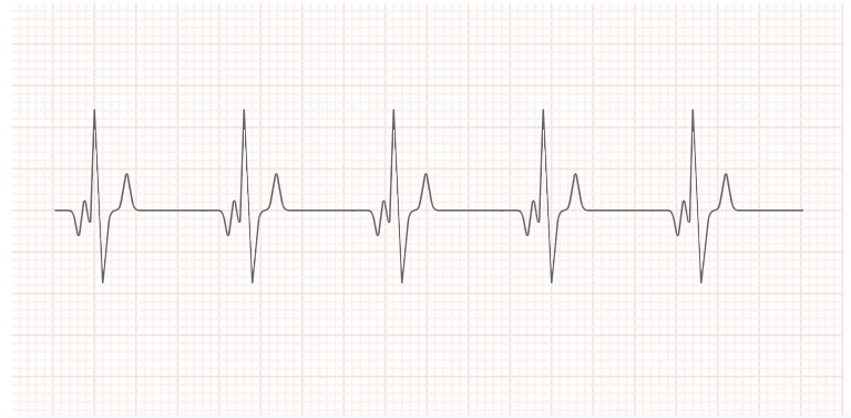 Рисунок с сайта «Гиперматика»