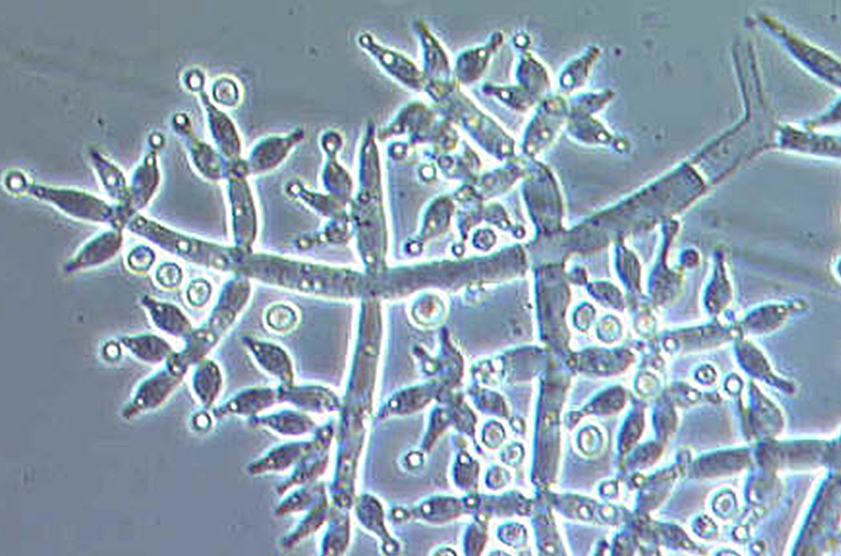Trichoderma harzianum. Фото: Wikimedia commons