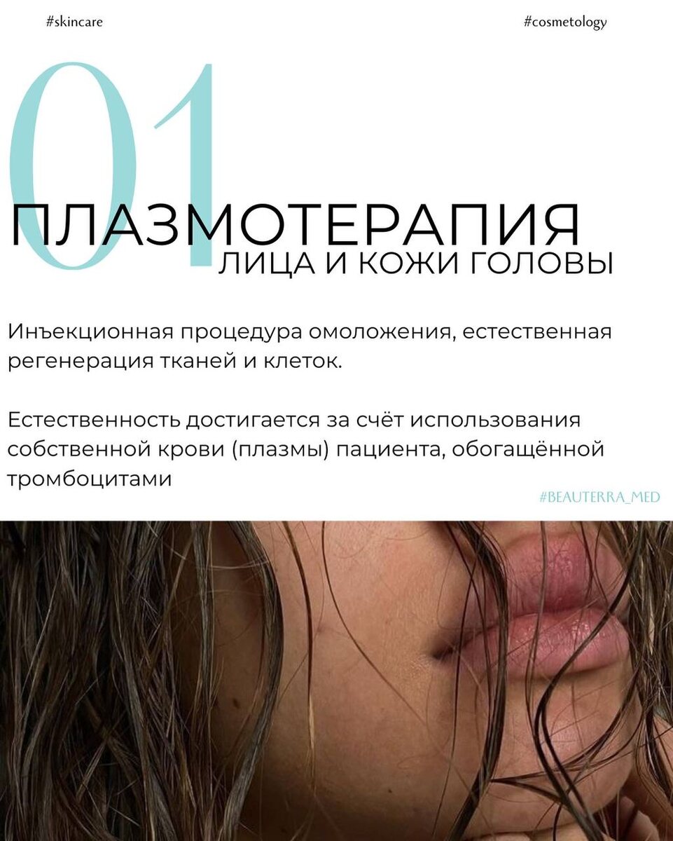 Плазмотерапия T-lab PRP-tube в клинике БЬЮТЕРРА