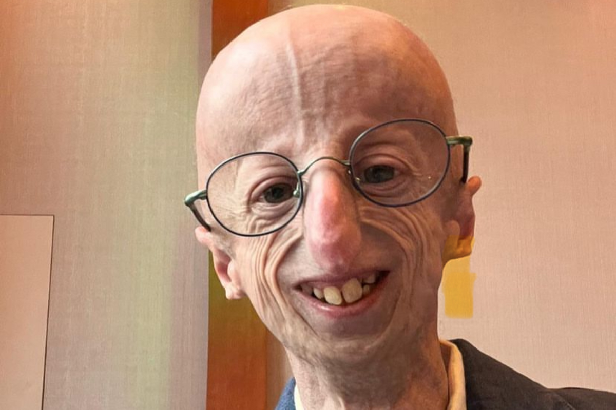    Сэмми Бассо