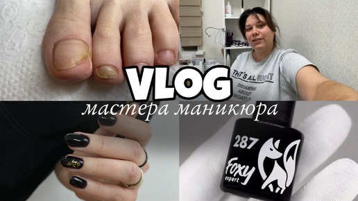 Nail Vlog 70 Будни мастера/У клиентки онихолизис