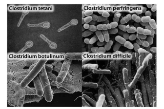Разновидности возбудителя столбняка.