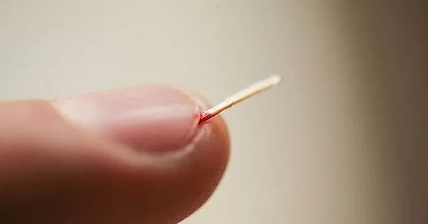 Вот мы и встретили....Столбняк. 