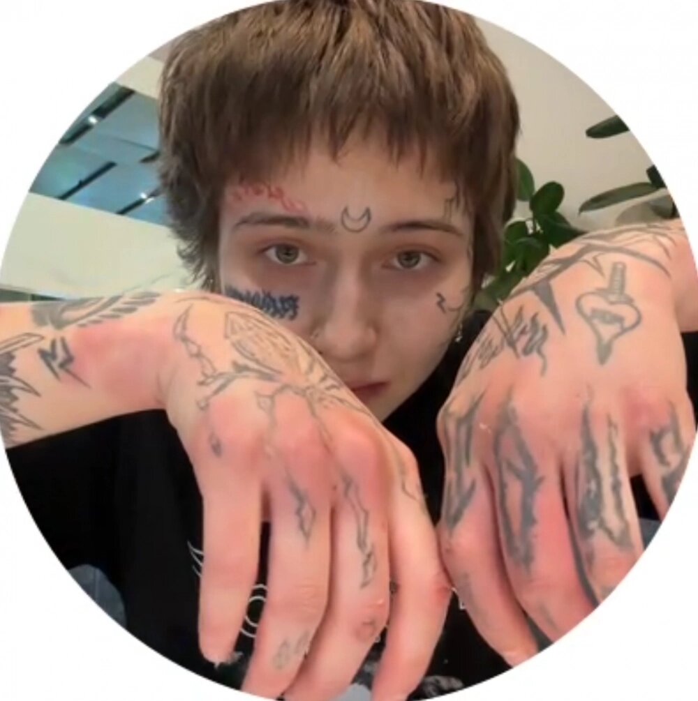    Виолетта показывает разбитые руки. Фото: Telegram-канал «Вилка / Китана»./ скриншот видео.