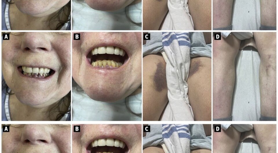   Kevin Murray et al. / The Canadian Medical Association Journal, 2024