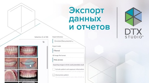 Экспорт данных и отчетов | DTX Studio Clinic