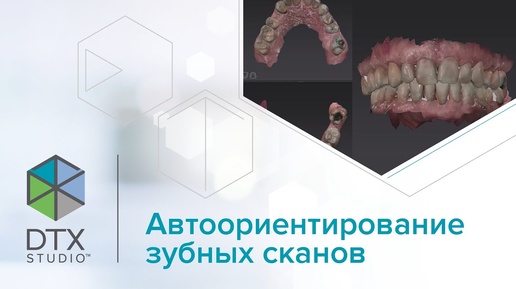 Автоориентирование зубных сканов | DTX Studio Clinic