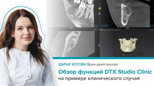 Обзор функций DTX Studio Clinic на примере клинического случая