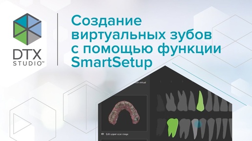 Создание виртуальных зубов с помощью функции SmartSetup | DTX Studio Clinic