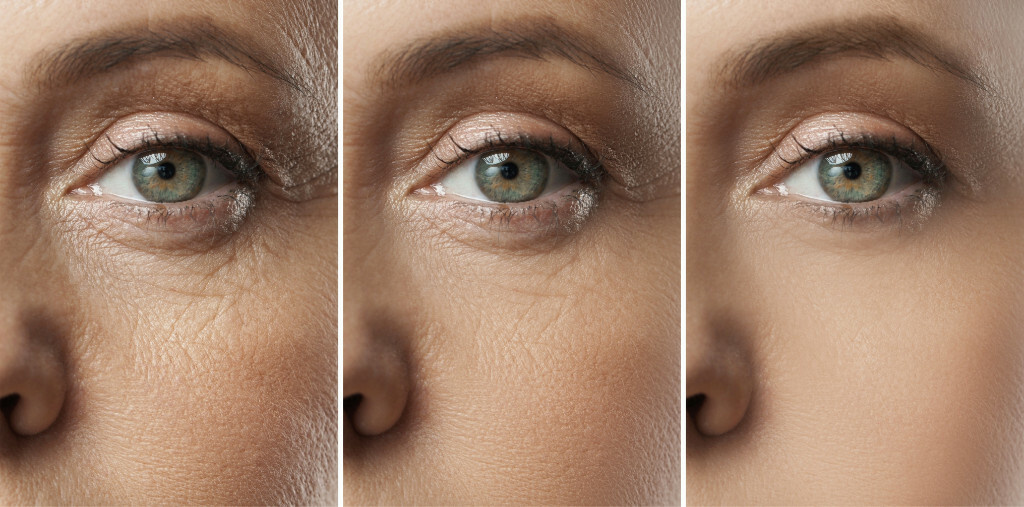 Фото: optim.tildacdn.com