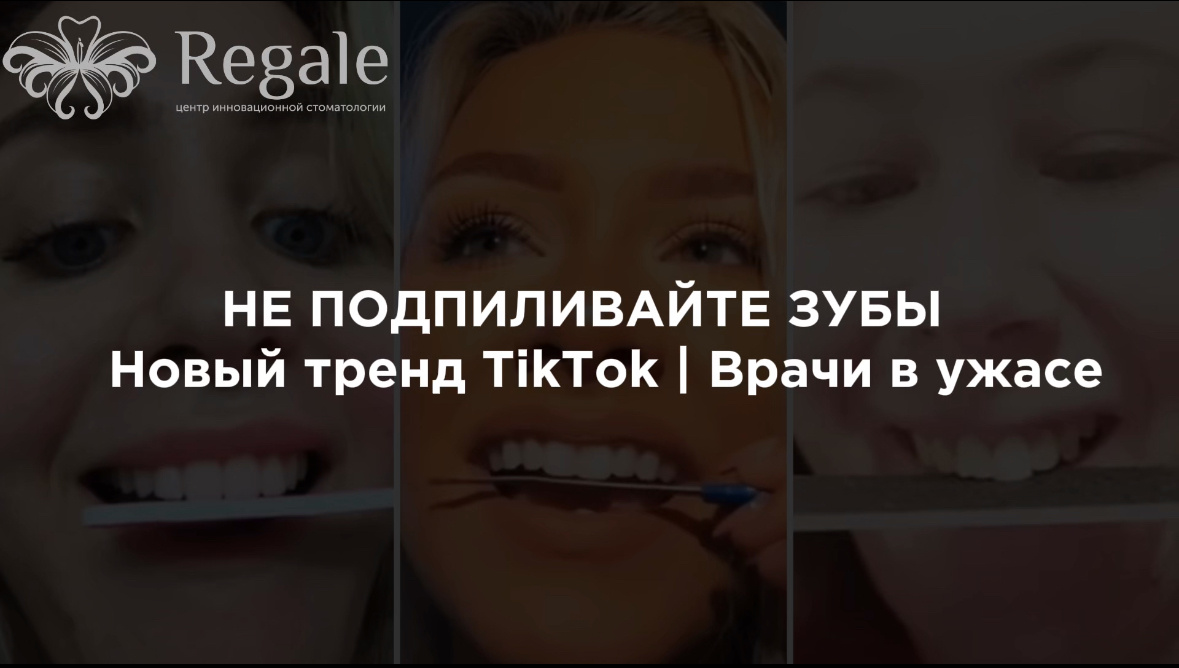 Подпиливание зубов может привести к воспалению, изменениям прикуса и повреждению эмали