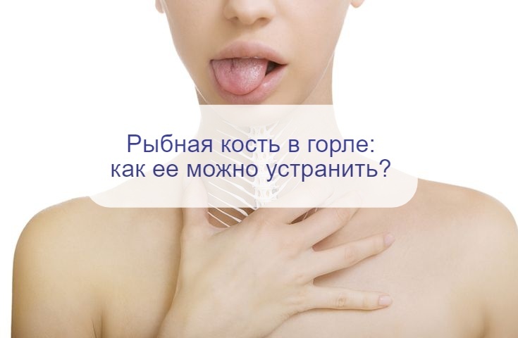 Опасная ситуация - застряла в горле рыбная кость: как помочь себе в этой ситуации