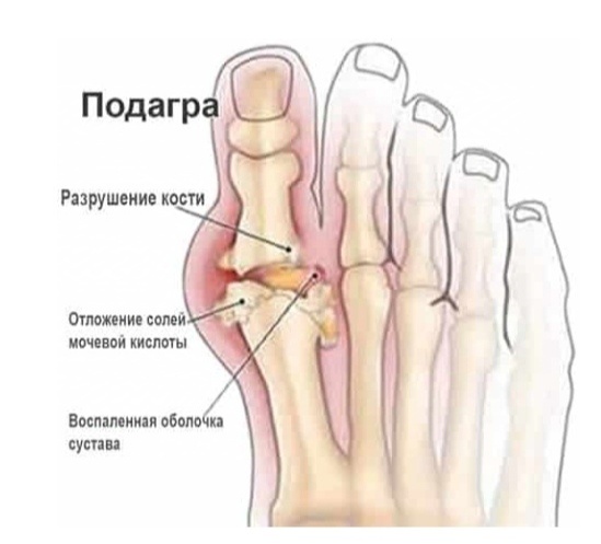 Фото с сайта osteopatcenter.ru