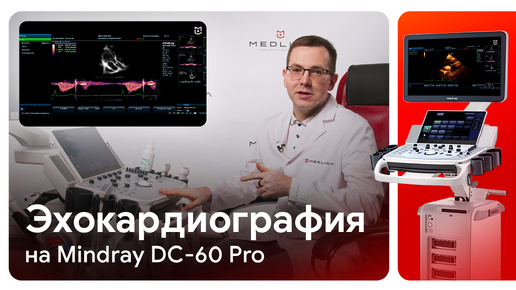 Эхокардиография (ЭхоКГ) на Mindray DC-60 Pro