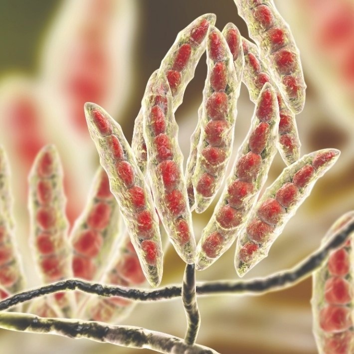 Фото 1. Фузариум под микроскопом