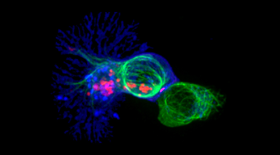   Alex Ritter, Jennifer Lippincott Schwartz and Gillian Griffiths, National Institutes of Health / Flickr / Public Domain