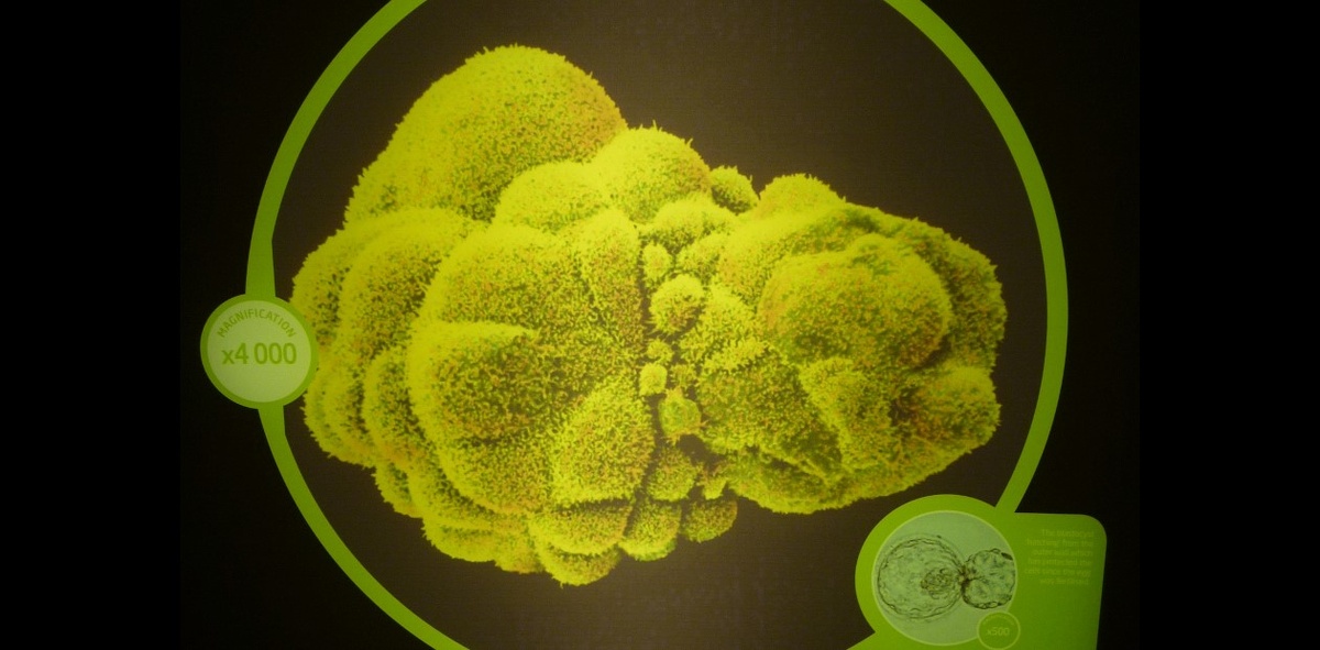 Человеческий эмбрион на 5-й день беременности. © CC BY 2.0/ Dunk