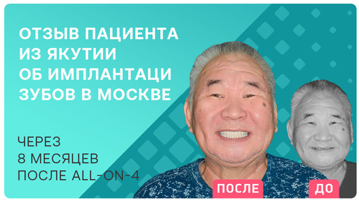 Насколько сильно имплантация зубов поменяет жизнь? Моя изменилась на 180 градусов!