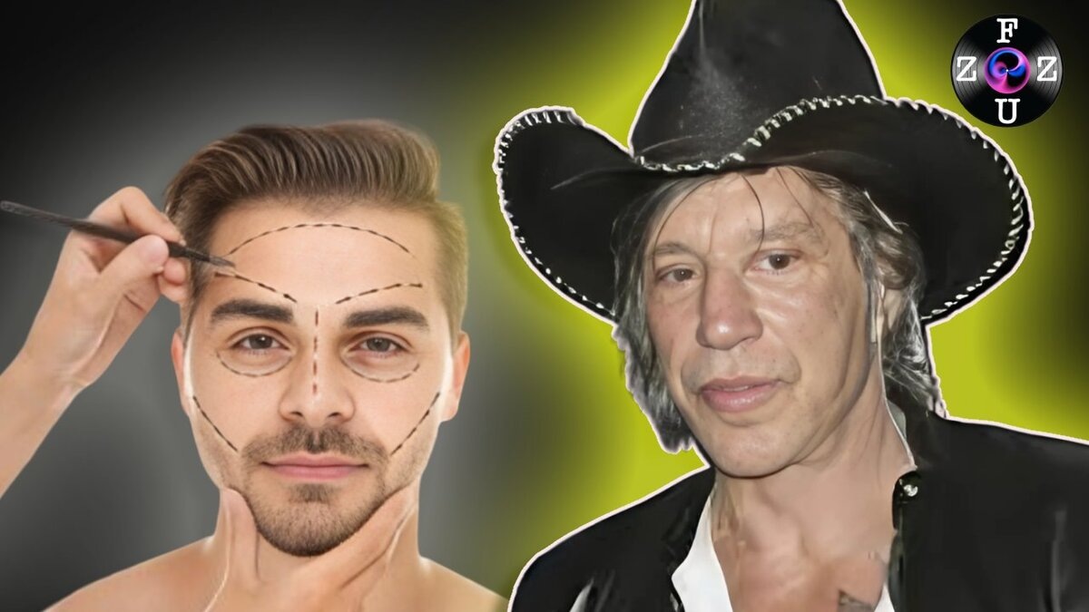 «Что с ними стало?» Знаменитости, которых время и пластика изменили до неузнаваемости 