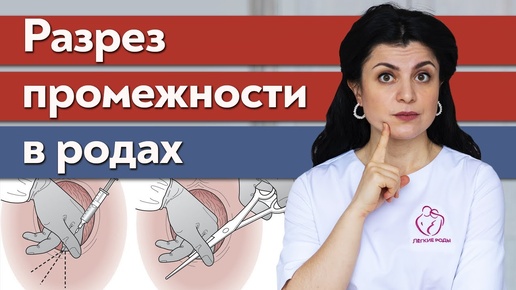 Что такое эпизиотомия в родах? / Какая вероятность повторной эпизиотомии?