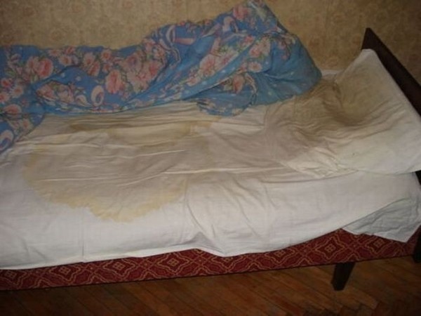 На фото постельное белье имеется. Но пятна похожие. Естественно, фото не с того вызова.