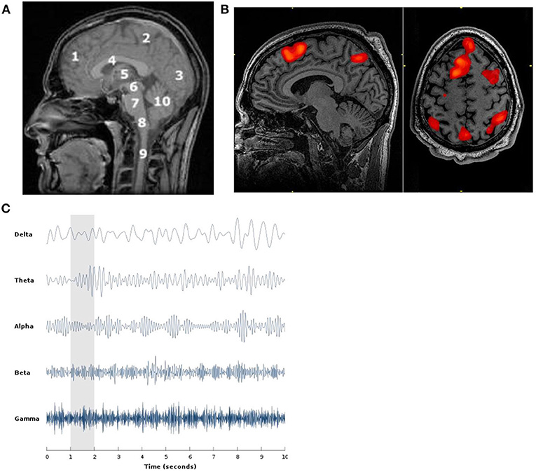 Рисунок 1. Примеры методов визуализации мозга. (A) МРТ головного мозга человека, показывающая структуры мозга. (B) ФМРТ, показывающая активность мозга в цветных областях. (C) Пример сигналов ЭЭГ, показывающий пять различных типов мозговых волн, которые указывают на разные типы активности мозга.