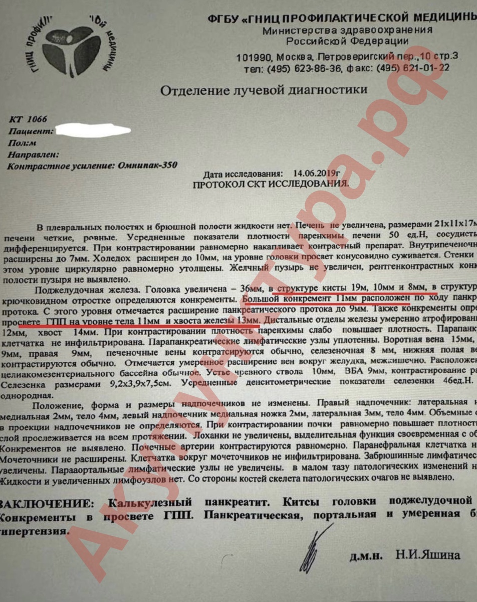 Узи до лечения