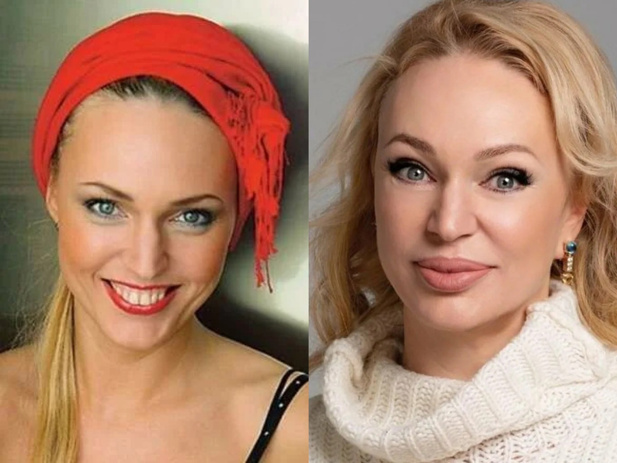 Алла Довлатова до и после