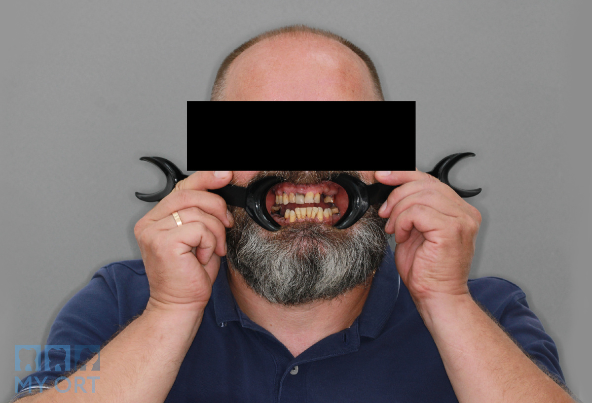 Фотопротокол. Ситуация ДО.