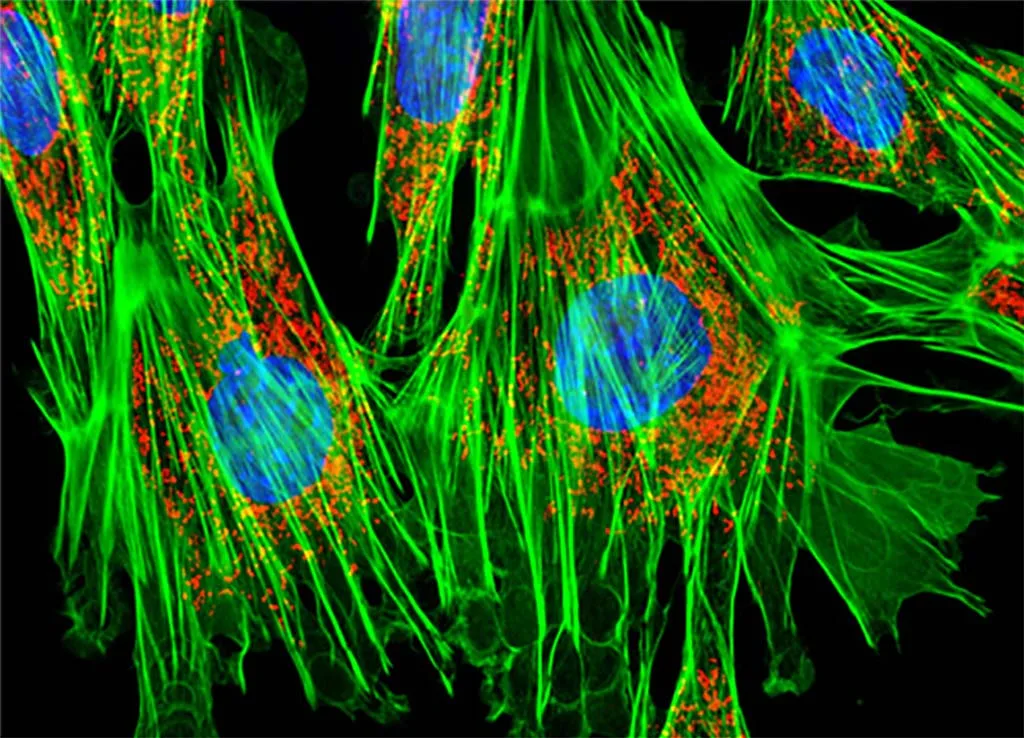 Фибробласты. Яндекс.Картинки