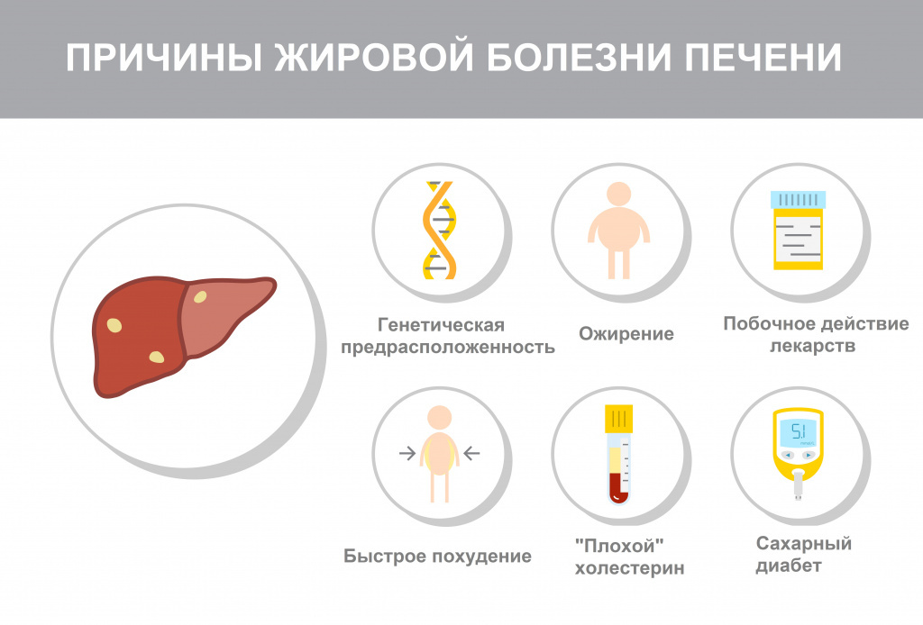 Стол при гепатозе