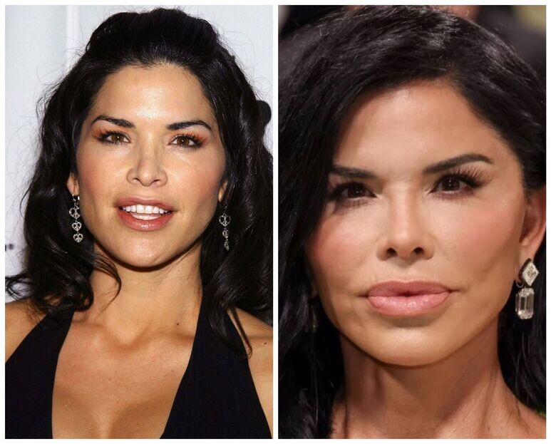     санчес фото