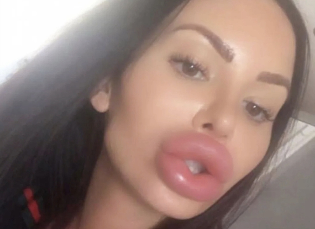 Очень сильно большие губы. Силиконовые губы. Очень сильно большие губы. Очень сильно большие губы. Силиконовые губы.