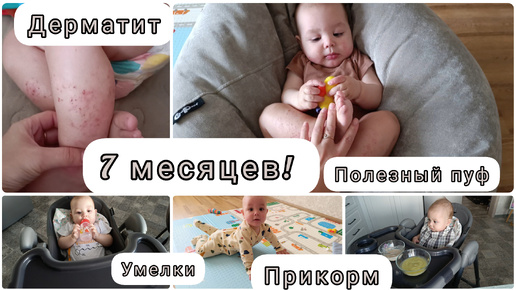 Нам 7 МЕСЯЦЕВ!👶Не ползает, не сидит, НЕТ зубов)🙃Аллергия/завершение ГВ