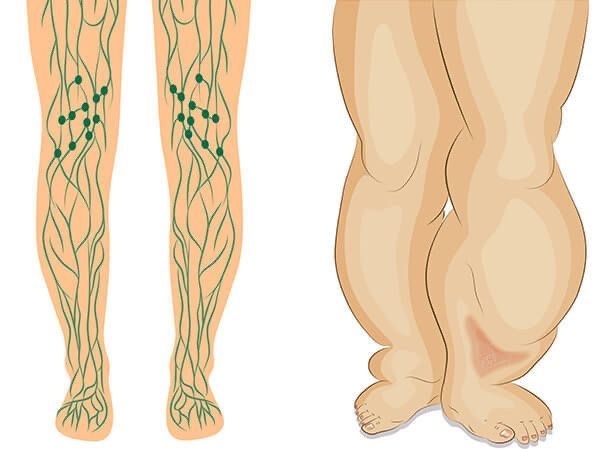 Когда обращаться ко врачу?