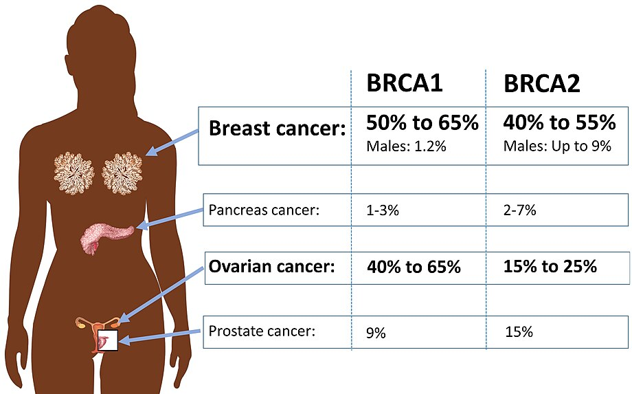 https://www.wikiwand.com/en/articles/BRCA_mutation