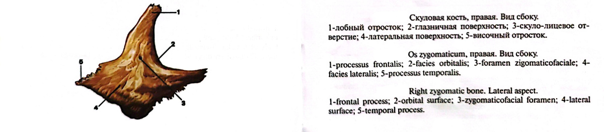Скуловая кость, правая. Вид сбоку. 